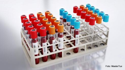 Bild zu Vitaminmangel per Bluttest erkennen: Geht das wirklich?