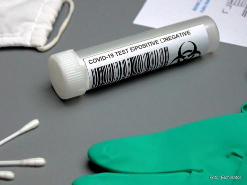 Bild zu Was Corona mit unserer Gesundheit macht