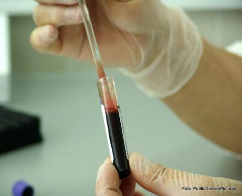 Bild zu Fortschritte in der Krebstherapie